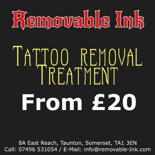 Removable Ink - Tattoo Removal Company in Taunton (UK)